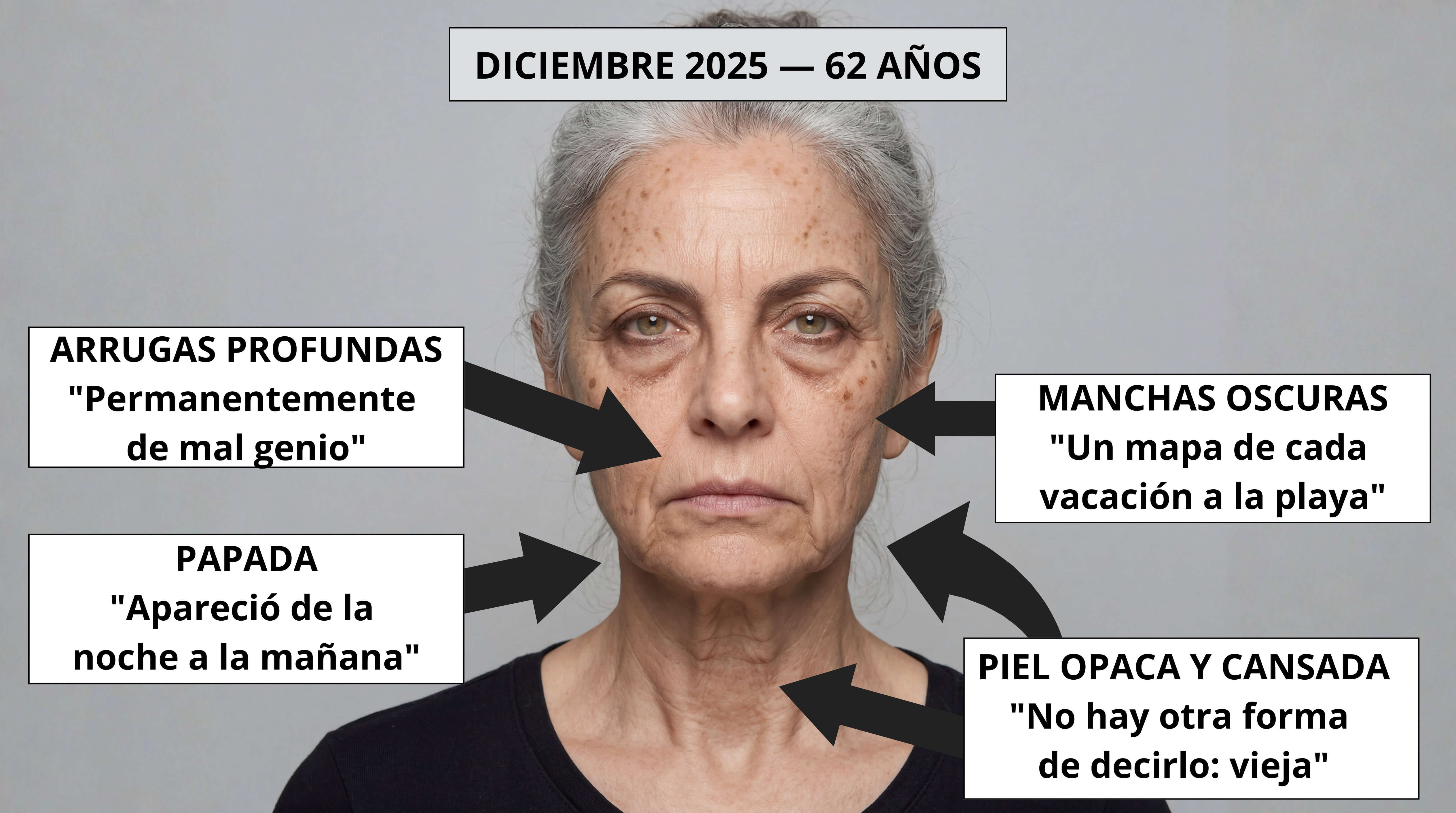 Rostro con arrugas profundas y manchas — diciembre 2025, 62 años